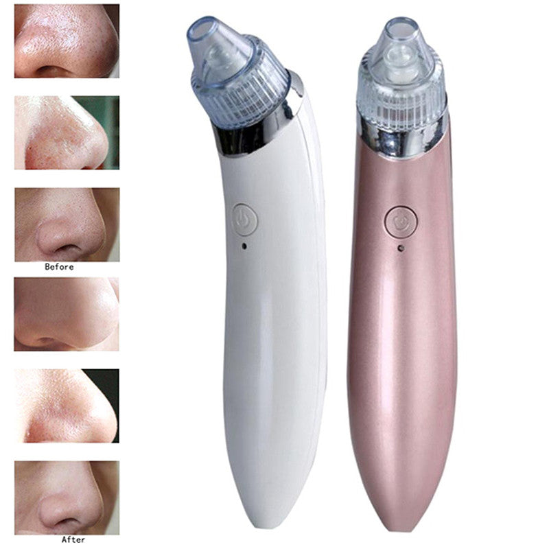 Electric \ To Blackheads Beauty Instrument